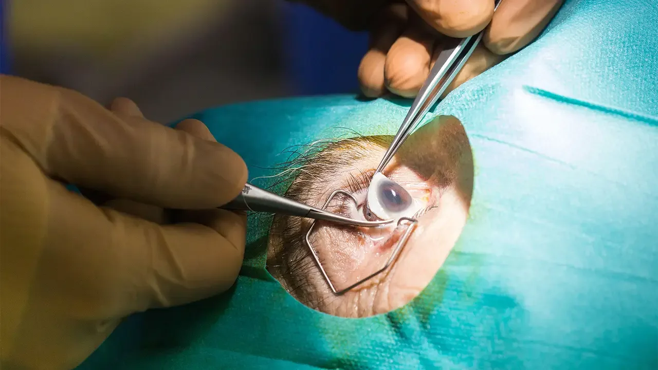 Eye bank facility dedicated to corneal donation and research